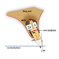 toothpositions1