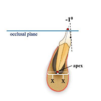 toothpositions2