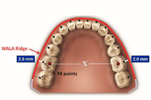 toothpositions3