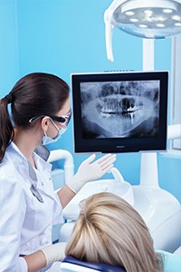 v-xray